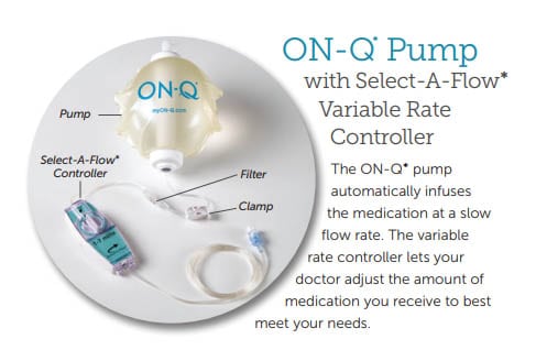 On-Q Painbuster Catheter
